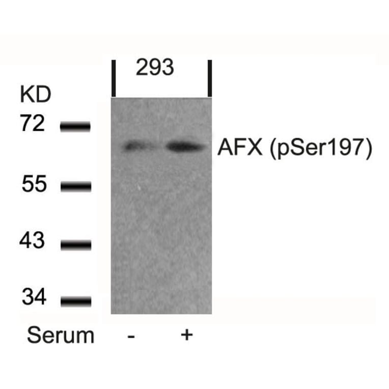 Western blot - AFX (Phospho-Ser197) Antibody from Signalway Antibody (11137) - Antibodies.com