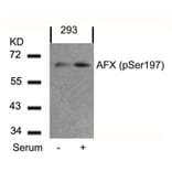 Western blot - AFX (Phospho-Ser197) Antibody from Signalway Antibody (11137) - Antibodies.com