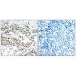 Immunohistochemistry - AFX (Phospho-Ser197) Antibody from Signalway Antibody (11137) - Antibodies.com