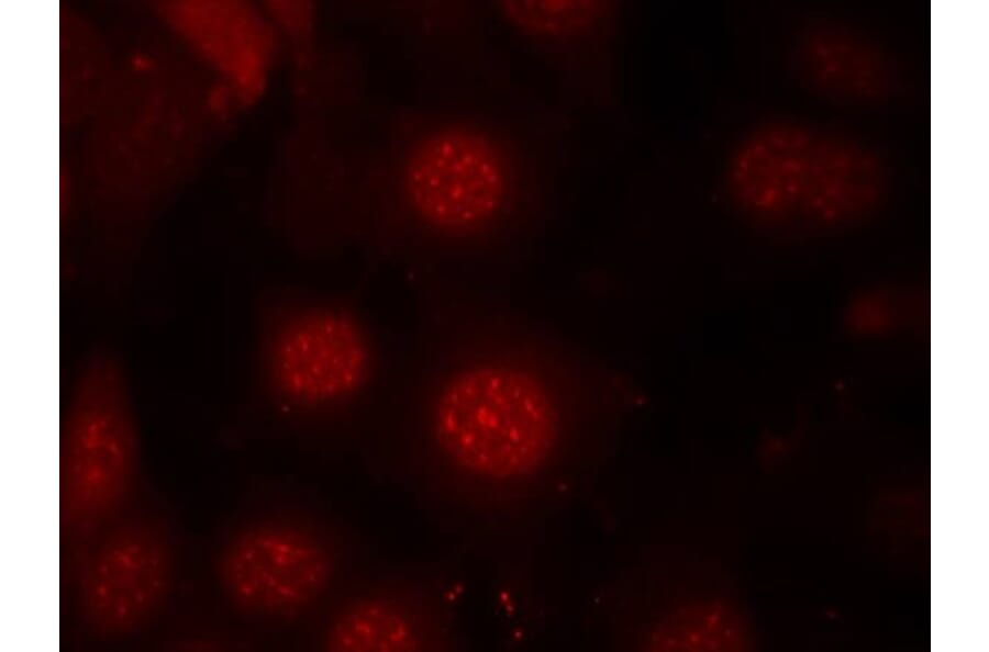 Immunofluorescence - AFX (Phospho-Ser197) Antibody from Signalway Antibody (11137) - Antibodies.com