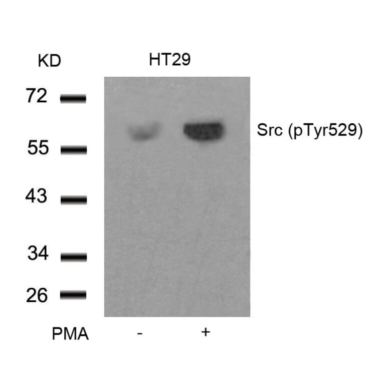 Western blot - Src (Phospho-Tyr529) Antibody from Signalway Antibody (11153) - Antibodies.com