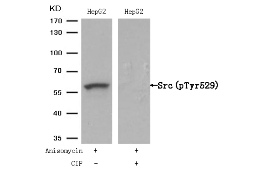 Western blot - Src (Phospho-Tyr529) Antibody from Signalway Antibody (11153) - Antibodies.com