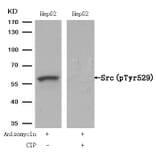 Western blot - Src (Phospho-Tyr529) Antibody from Signalway Antibody (11153) - Antibodies.com