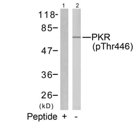 Western blot - PKR (Phospho-Thr446) Antibody from Signalway Antibody (11280) - Antibodies.com
