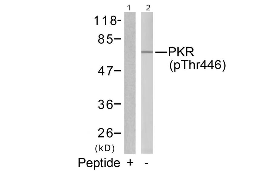 Western blot - PKR (Phospho-Thr446) Antibody from Signalway Antibody (11280) - Antibodies.com