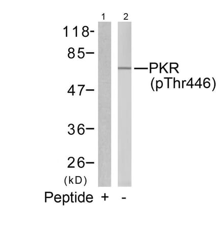 Western blot - PKR (Phospho-Thr446) Antibody from Signalway Antibody (11280) - Antibodies.com