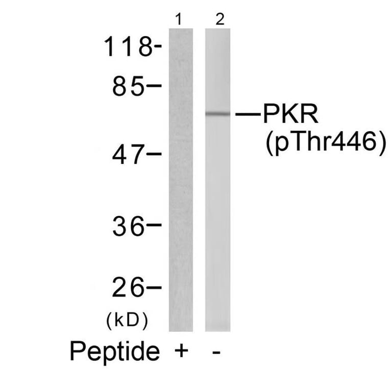 Western blot - PKR (Phospho-Thr446) Antibody from Signalway Antibody (11280) - Antibodies.com