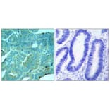 Immunohistochemistry - PKR (Phospho-Thr446) Antibody from Signalway Antibody (11280) - Antibodies.com