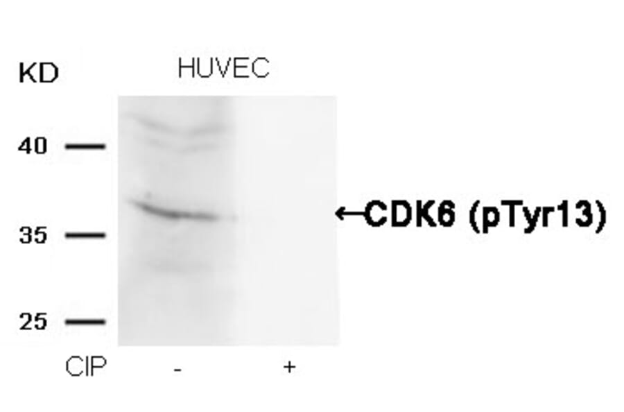 Western blot - CDK6 (phospho-Tyr13) Antibody from Signalway Antibody (11542) - Antibodies.com