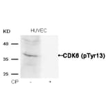 Western blot - CDK6 (phospho-Tyr13) Antibody from Signalway Antibody (11542) - Antibodies.com