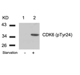 Western blot - CDK6 (phospho-Tyr24) Antibody from Signalway Antibody (11543) - Antibodies.com