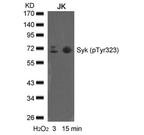 Western blot - syk (phospho-Tyr323) Antibody from Signalway Antibody (11546) - Antibodies.com