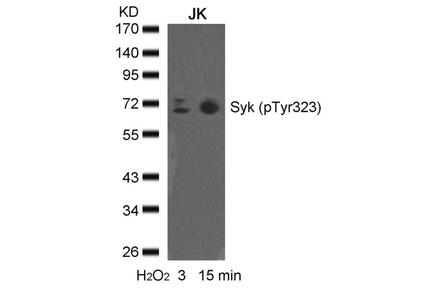 Western blot - syk (phospho-Tyr323) Antibody from Signalway Antibody (11546) - Antibodies.com