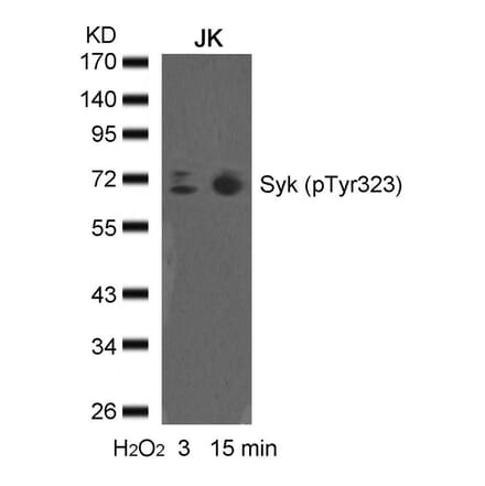 Western blot - syk (phospho-Tyr323) Antibody from Signalway Antibody (11546) - Antibodies.com