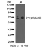 Western blot - syk (phospho-Tyr323) Antibody from Signalway Antibody (11546) - Antibodies.com