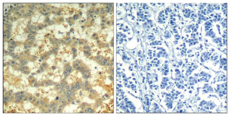 Anti-syk (phospho-Tyr323) Antibody (A50219) | Antibodies.com