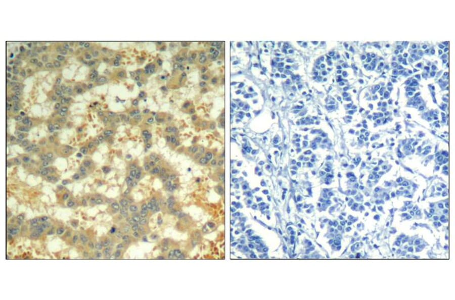 Immunohistochemistry - syk (phospho-Tyr323) Antibody from Signalway Antibody (11546) - Antibodies.com