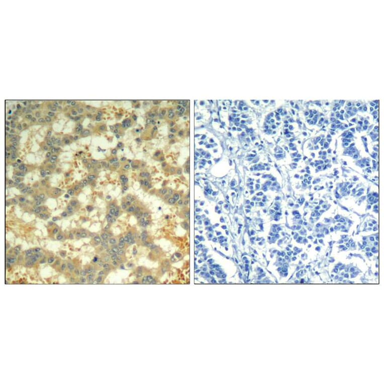 Immunohistochemistry - syk (phospho-Tyr323) Antibody from Signalway Antibody (11546) - Antibodies.com
