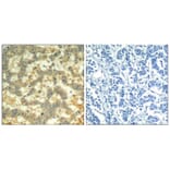 Immunohistochemistry - syk (phospho-Tyr323) Antibody from Signalway Antibody (11546) - Antibodies.com