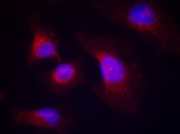 Anti-syk (phospho-Tyr323) Antibody (A50219) | Antibodies.com