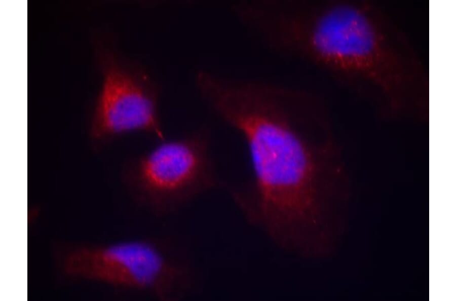 Immunofluorescence - syk (phospho-Tyr323) Antibody from Signalway Antibody (11546) - Antibodies.com