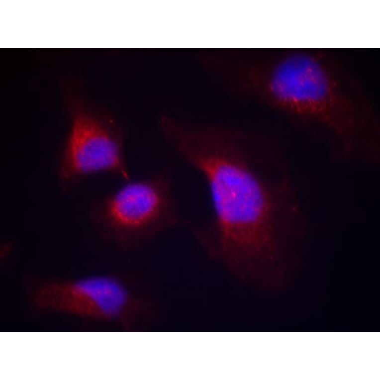Immunofluorescence - syk (phospho-Tyr323) Antibody from Signalway Antibody (11546) - Antibodies.com