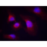 Immunofluorescence - syk (phospho-Tyr323) Antibody from Signalway Antibody (11546) - Antibodies.com