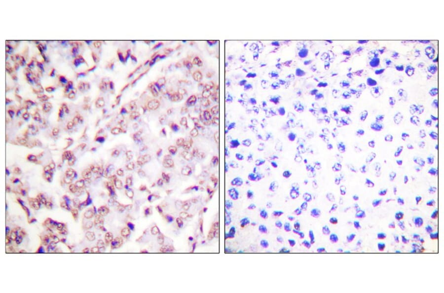 Immunohistochemistry - ETS1 (Phospho-Thr38) Antibody from Signalway Antibody (11658) - Antibodies.com