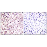 Immunohistochemistry - ETS1 (Phospho-Thr38) Antibody from Signalway Antibody (11658) - Antibodies.com