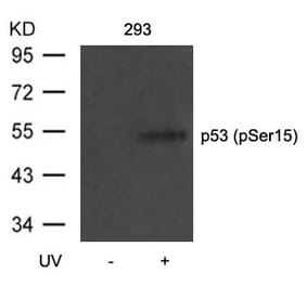Western blot - p53 (Phospho-Ser15) Antibody from Signalway Antibody (11094) - Antibodies.com
