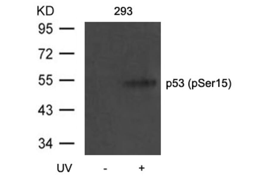 Western blot - p53 (Phospho-Ser15) Antibody from Signalway Antibody (11094) - Antibodies.com