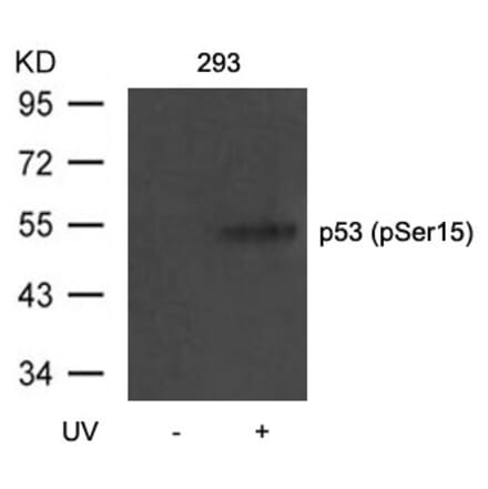Western blot - p53 (Phospho-Ser15) Antibody from Signalway Antibody (11094) - Antibodies.com