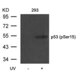 Western blot - p53 (Phospho-Ser15) Antibody from Signalway Antibody (11094) - Antibodies.com