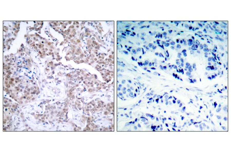 Immunohistochemistry - p53 (Phospho-Ser15) Antibody from Signalway Antibody (11094) - Antibodies.com