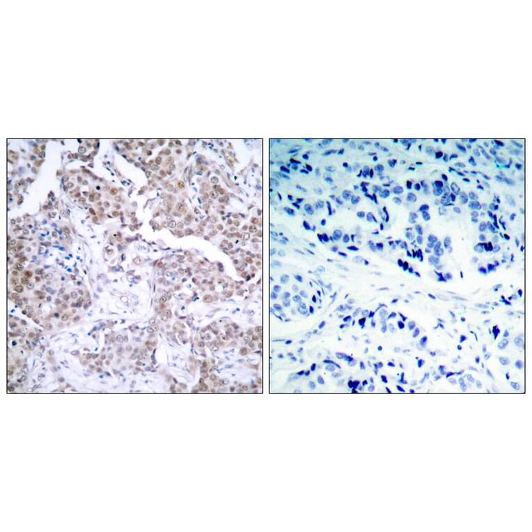Immunohistochemistry - p53 (Phospho-Ser15) Antibody from Signalway Antibody (11094) - Antibodies.com