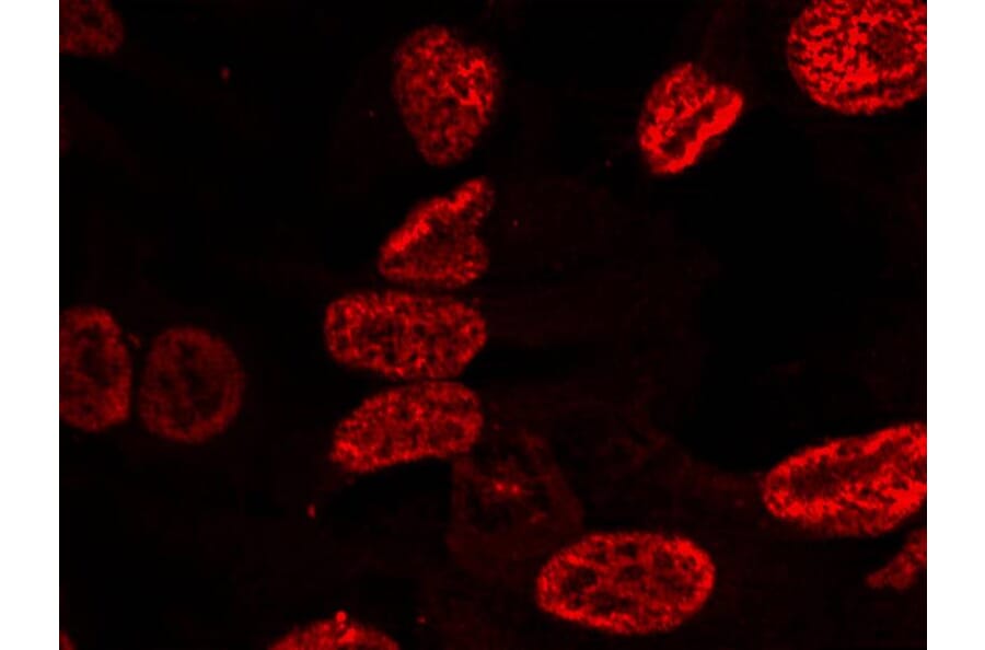 Immunofluorescence - p53 (Phospho-Ser15) Antibody from Signalway Antibody (11094) - Antibodies.com