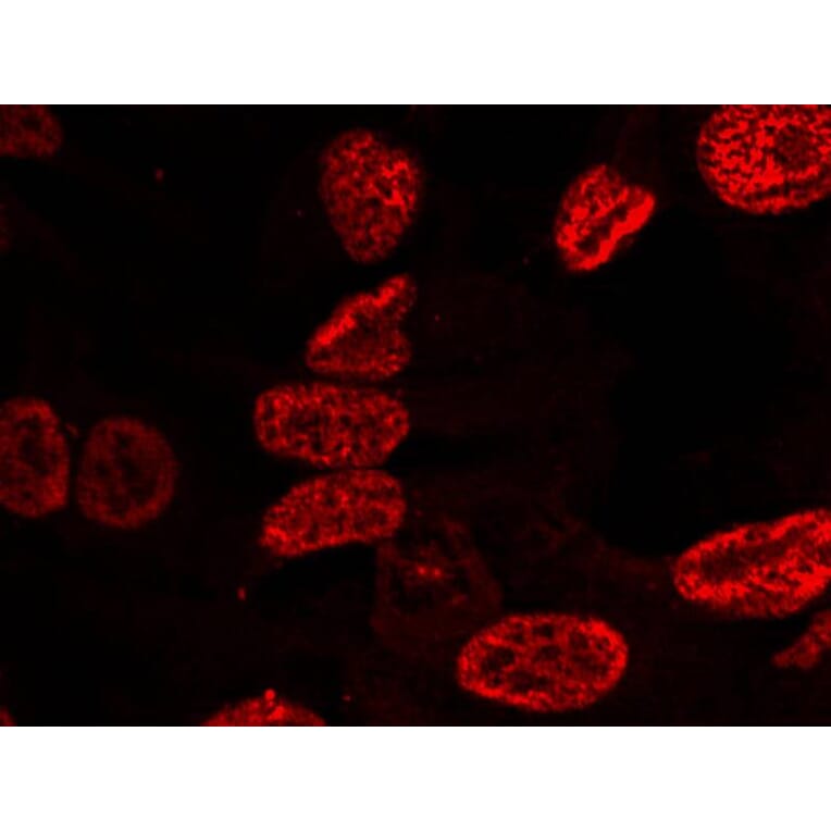 Immunofluorescence - p53 (Phospho-Ser15) Antibody from Signalway Antibody (11094) - Antibodies.com