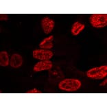 Immunofluorescence - p53 (Phospho-Ser15) Antibody from Signalway Antibody (11094) - Antibodies.com