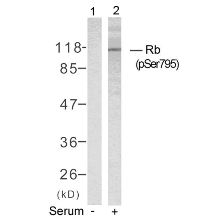 Western blot - Rb (Phospho-Ser795) Antibody from Signalway Antibody (11130) - Antibodies.com