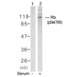 Western blot - Rb (Phospho-Ser795) Antibody from Signalway Antibody (11130) - Antibodies.com