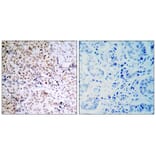 Immunohistochemistry - Rb (Phospho-Ser795) Antibody from Signalway Antibody (11130) - Antibodies.com