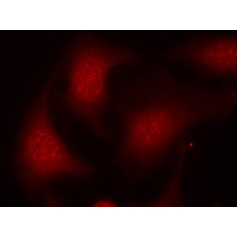 Immunofluorescence - Rb (Phospho-Ser795) Antibody from Signalway Antibody (11130) - Antibodies.com