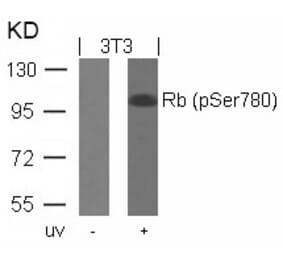 Western blot - Rb (Phospho-Ser780) Antibody from Signalway Antibody (11132) - Antibodies.com