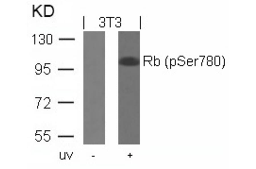 Western blot - Rb (Phospho-Ser780) Antibody from Signalway Antibody (11132) - Antibodies.com