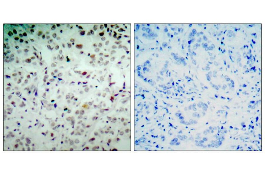 Immunohistochemistry - Rb (Phospho-Ser780) Antibody from Signalway Antibody (11132) - Antibodies.com