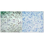 Immunohistochemistry - Rb (Phospho-Ser780) Antibody from Signalway Antibody (11132) - Antibodies.com
