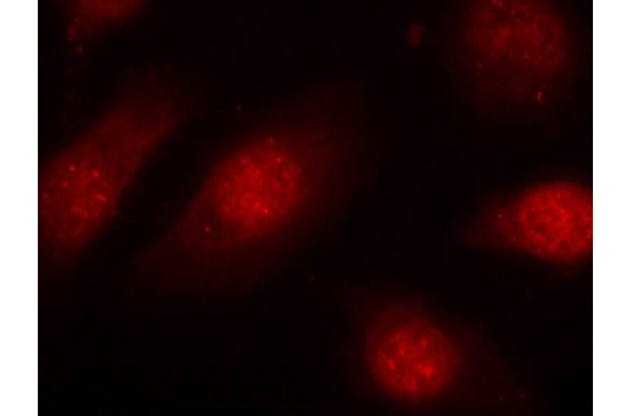 Immunofluorescence - Rb (Phospho-Ser780) Antibody from Signalway Antibody (11132) - Antibodies.com