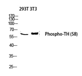 Western blot - TH (Phospho-Ser8) Polyclonal Antibody from Signalway Antibody (12309) - Antibodies.com