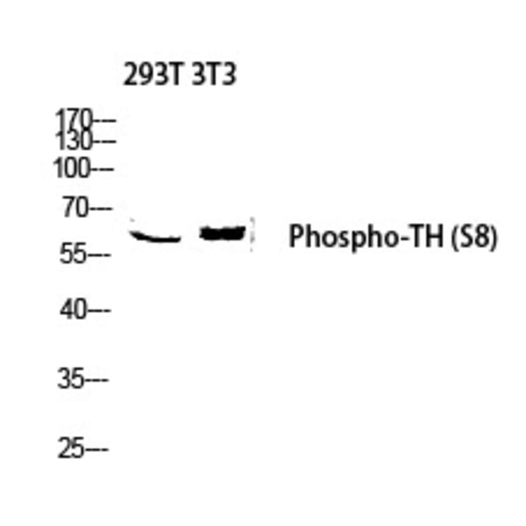 Western blot - TH (Phospho-Ser8) Polyclonal Antibody from Signalway Antibody (12309) - Antibodies.com