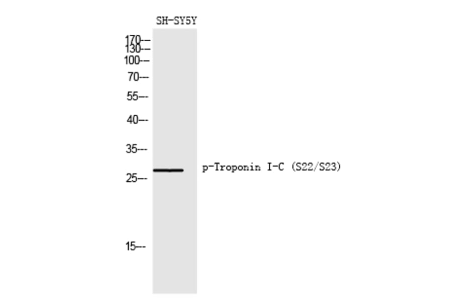 Western blot - Troponin I-C (Phospho-Ser22/Ser23) Polyclonal Antibody from Signalway Antibody - Antibodies.com